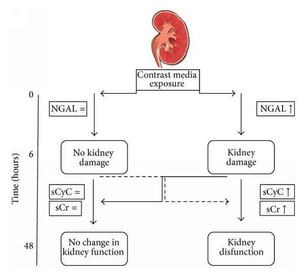 CysC與NGAL、Cr的關(guān)系