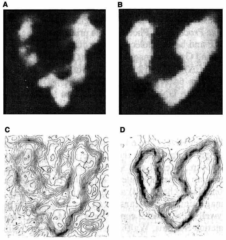 AFP的空間結(jié)構(gòu)